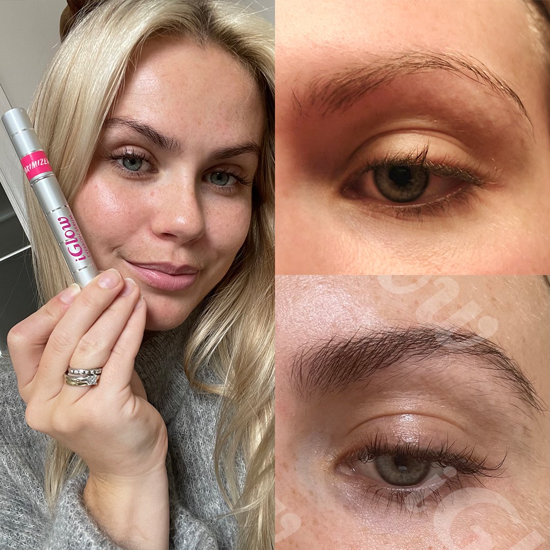 The Brow Growth Cycle - iGlow Cosmetics