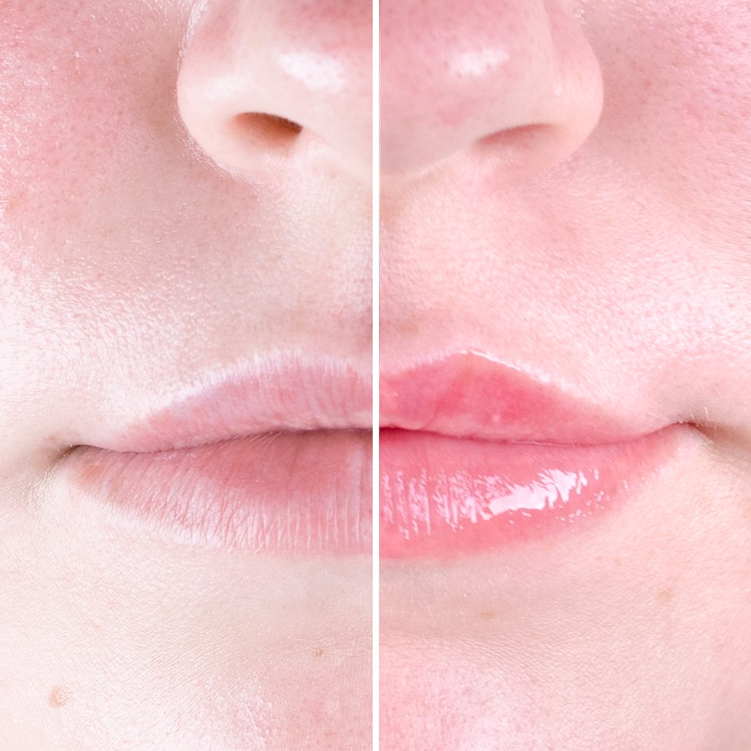 iGlow Chili Lips - Lip Plumper - Peach - iGlow Cosmetics