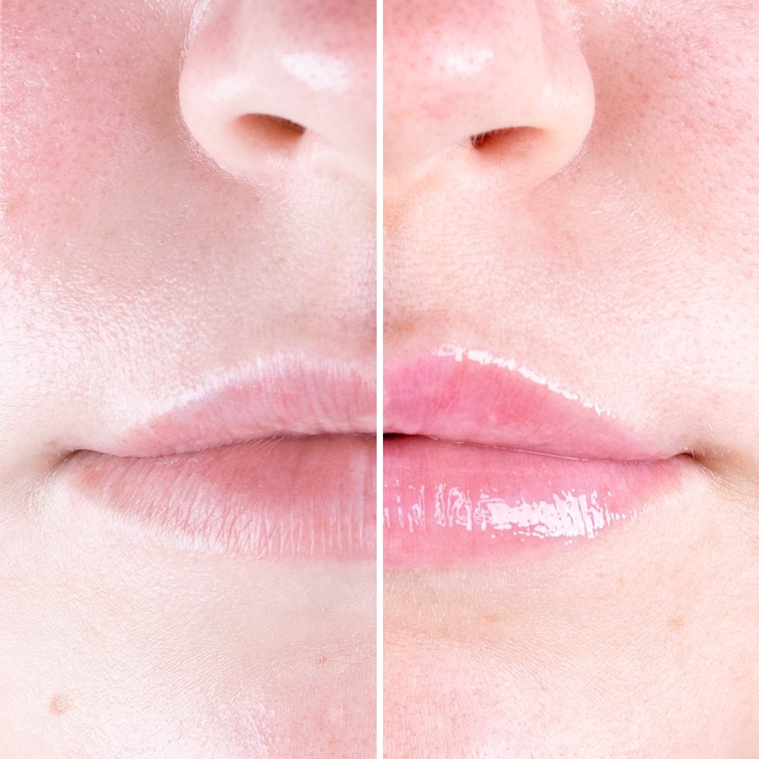 iGlow Chili Lips - Lip Plumper - Soft Pink - iGlow Cosmetics